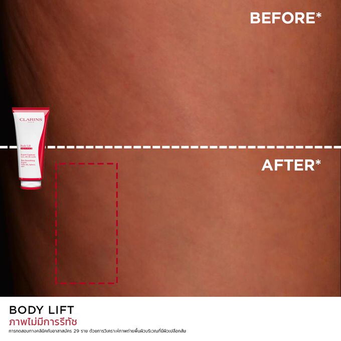Body Lift Active