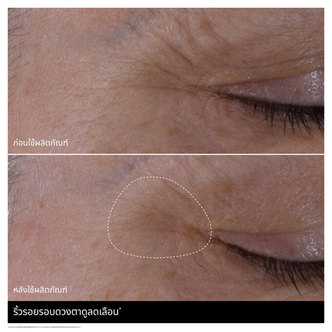 DOUBLE SERUM EYE | ����ç��®