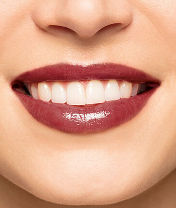 Peau Matte teinte 17