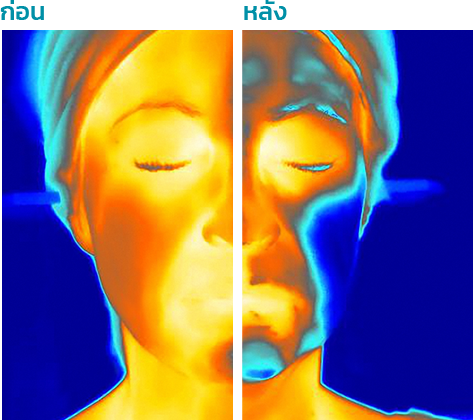 ก่อน หลัง